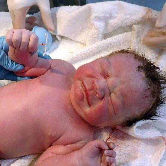 Photo of गर्भनिरोधक गोली के साथ पैदा हुआ ये बच्चा, सोशल मीडिया पर फोटो हुई वायरल