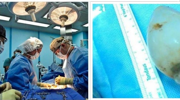 3 साल बाद सुनी मां ने मृत बेटे की धड़कनें,