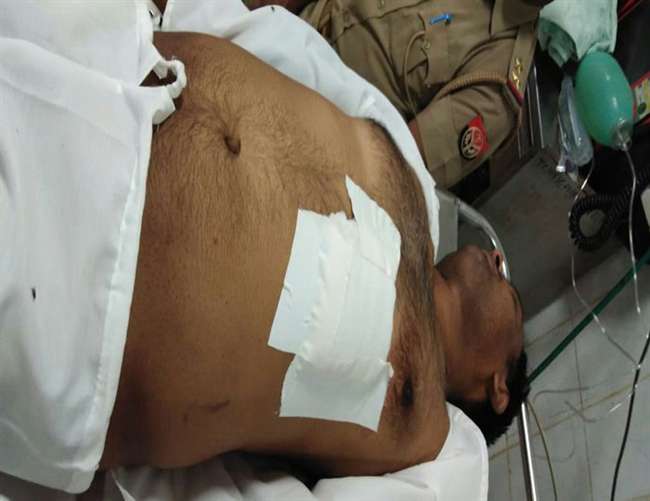 चंदौली: बेखौफ बदमाशों ने दारोगा को गोली मारी, BHU ट्रामा सेंटर में भर्ती