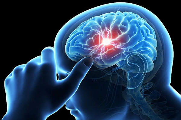 ब्रेन स्ट्रोक में सुनने-देखने की क्षमता खो देता है मरीज, दुनिया का हर छठा व्यक्ति है इसका शिकार