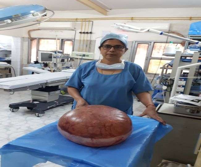 Photo of 50 वर्षीय महिला पेट दर्द का इलाज कराने पहुंची महिला, ऑपरेशन में निकला कुछ ऐसा