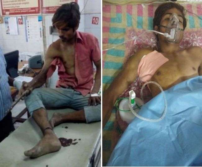 Photo of कांख में घुसी तीन फीट लंबी सरिया, डॉक्टरों ने करीब दो घंटे के ऑपरेशन के बाद निकाली बाहर