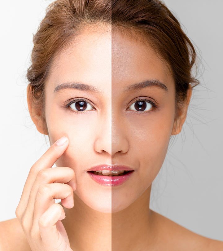 Photo of ऑयली स्किन से परेशान, तो अपनाए ये घरेलू उपाय