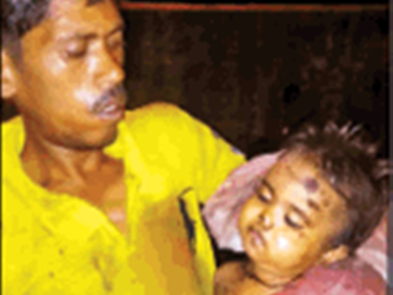 Photo of Dog Bite Death : बच्ची मां के साथ दरवाजे पर खड़ी थी, तभी कुत्ते ने उस पर हमला कर दिया और कई जगह काट लिया