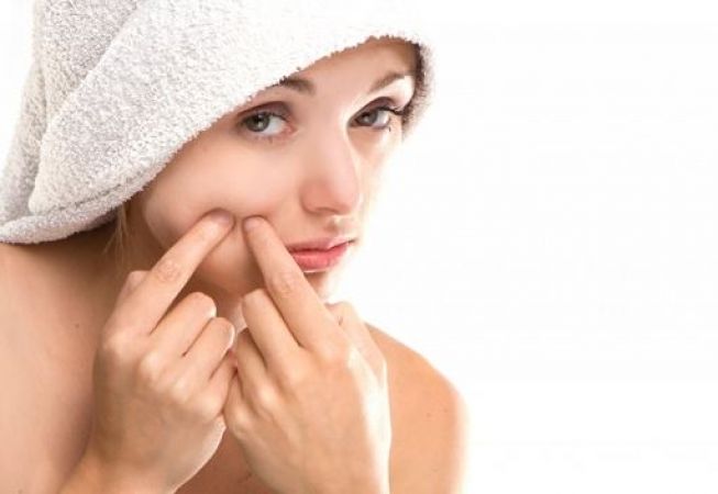 Photo of कभी ना दबाएं चेहरे के पिम्पल, हो सकते हैं ये इन्फेक्शन