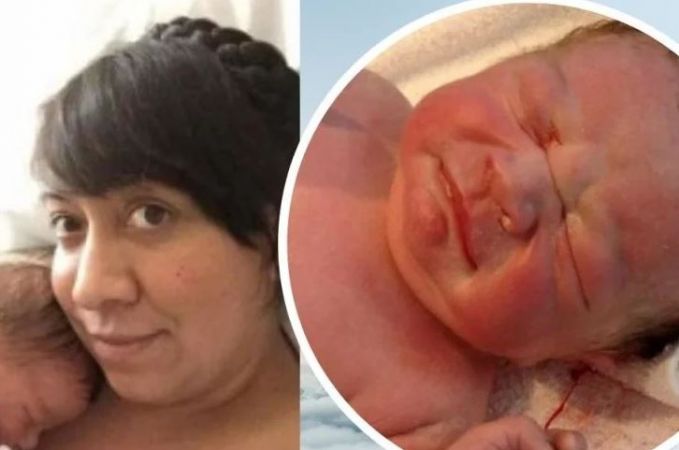 Photo of अपनी मौत लेकर पैदा हुआ यह बच्चा, काफी दर्दनाक है माँ की दास्तां