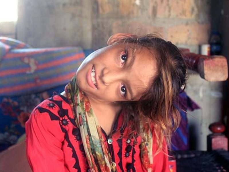 Photo of पाकिस्तान: 90 डिग्री मुड़ गई इस लड़की की गर्दन, जानें कैसे हुआ यह हादसा…