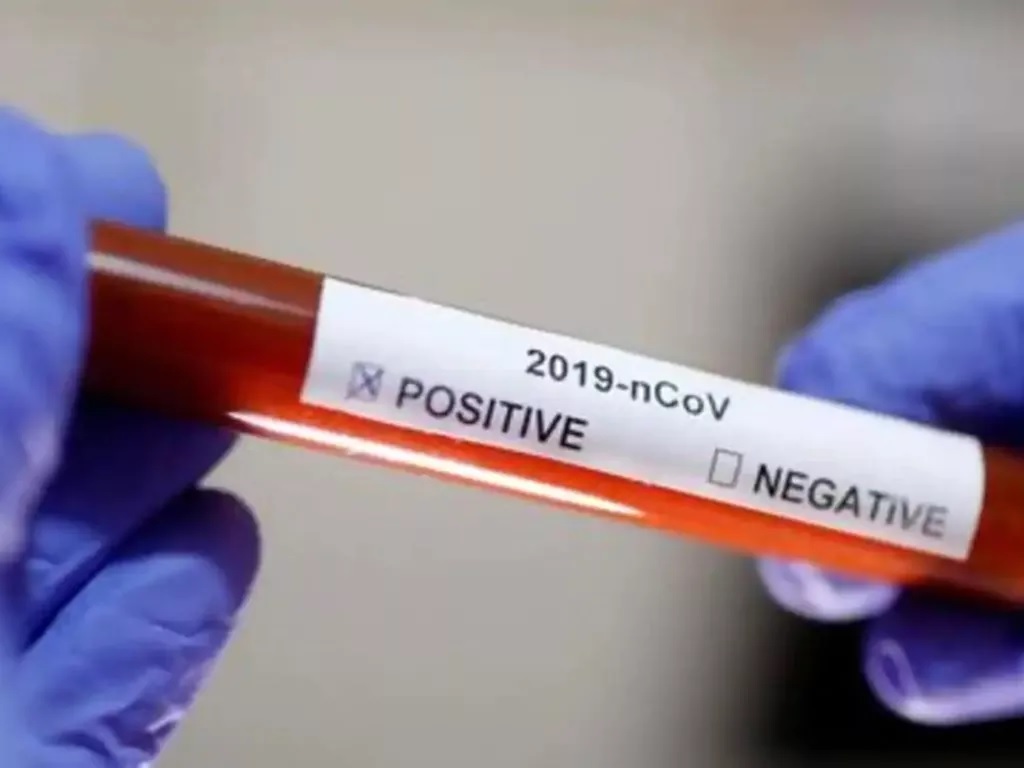 Photo of खांसी, छींक से आठ मीटर तक जा सकता है वायरस: वैज्ञानिक