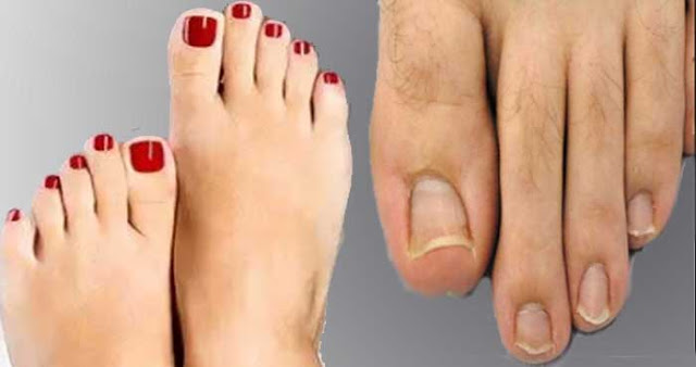 Photo of अगर आपकी भी पैर की दूसरी उंगली अंगूठे से बड़ी है तो, जरुर पढ़ ले खबर…