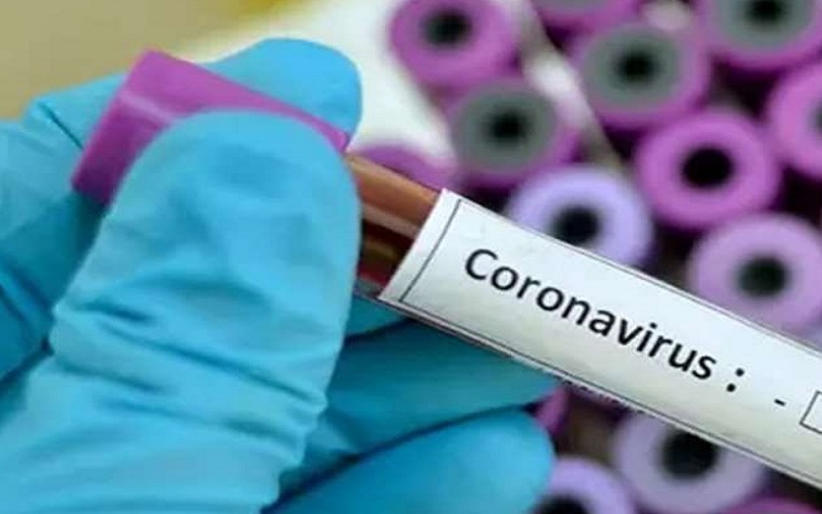 Photo of लखनऊ में अचानक बढ़ा कोरोना वायरस का खतरा, बड़ी संख्या में मिले पॉजिटिव केस
