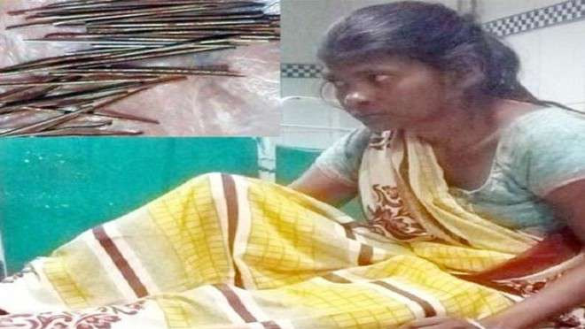 Photo of इस लड़की के पांव से लगातार निकल रही थी कीलें, जब डॉक्टर्स ने पता लगाने की कोशिश की तो…