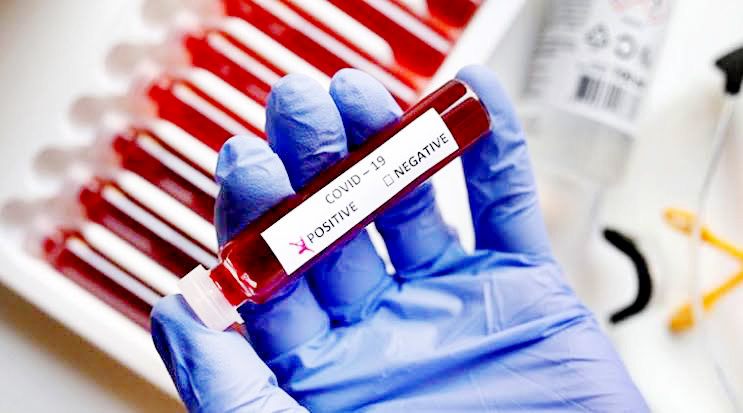 Photo of बहराइच में एक ज्वैलर्स के परिवार के 12 लोग मिले संक्रमित, एक दिन में आये 35 नए मामले