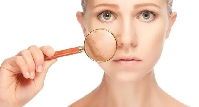 Photo of इन टिप्स को अपनाकर स्किन पिगमेंटेशन से पाए छुटकारा