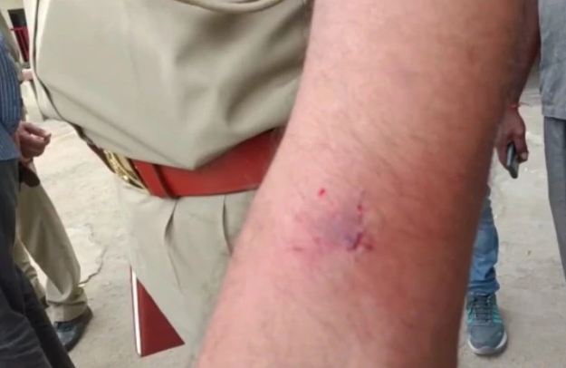 Photo of नो एंट्री में वाहन ले जाने से रोका तो युवती ने महिला पुलिसकर्मी को पीटा, दरोगा के हाथ में काटा