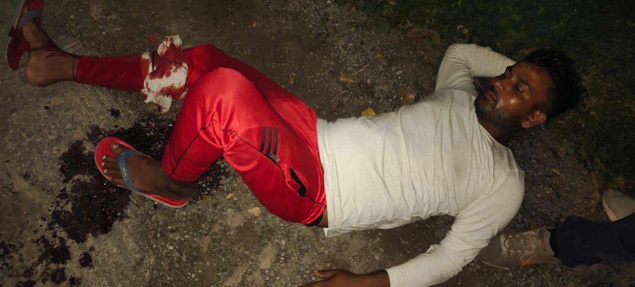 Photo of 25 हज़ार का इनामी मुठभेड़ के बाद गिरफ्तार, पैर में लगी गोली, सिपाही भी घायल