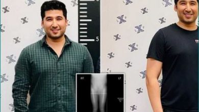 Photo of जानिए एक ऐसे युवक के बारे में जिन्होंने सर्जरी से बढ़ा ली अपनी हाइट