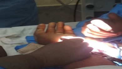 Photo of डॉक्टर भी हुए हैरान, दो टुकड़ों में कटा हाथ और फिर…