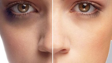 Photo of डार्क सर्कल्स को दूर करने के लिए अपनाए ये खास टिप्स