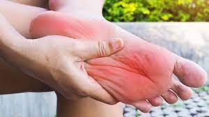 Photo of इन घरेलू तरीकों से पाएं पैरों के तलवों की जलन से छुटकारा