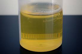 Photo of यह महिला पीती हैं अपना यूरिन वजह जानकर उड़ जाएंगे आपके होश