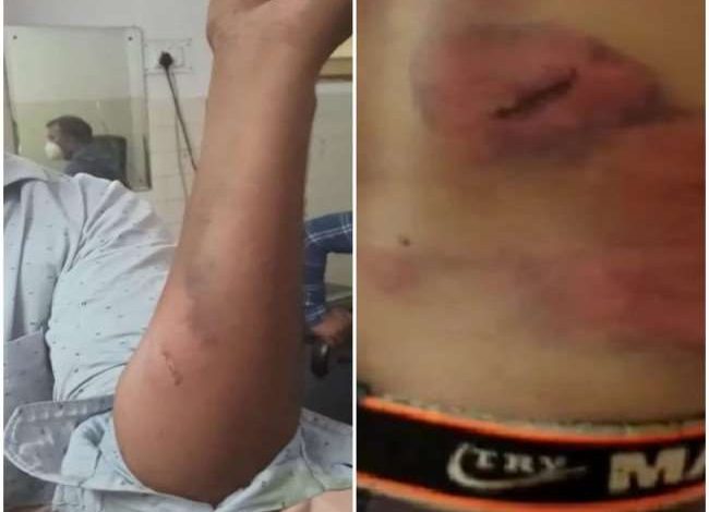 Photo of गाली गलौज करने वाले पांच युवकों को रातभर पुलिस चौकी में मार-मारकर उधेड़ दी चमड़ी…