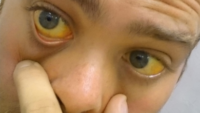 Photo of पीलिया से बचने के लिए कुछ खास टिप्स…