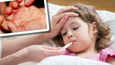 Photo of लखनऊ में पैर पसार रहा है टोमैटो फ्लू, सभी अस्पतालों में अलर्ट जारी￼