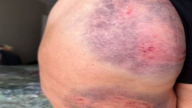 Photo of समुद्र में नहाने गई महिला की अचानक हुई ऐसी हालत, वजह जानकर हिल गया सबका दिमाग