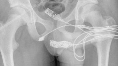 Photo of प्राइवेट पार्ट नापने के चक्कर में लड़के ने किया खौफनाक काम, जिसे सुनकर डॉक्टर्स भी हो गए हैरान