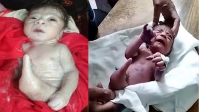 Photo of बेहद अनोखा जन्मा ये बच्चा, जिसे देख सभी हो गए हैरान￼￼