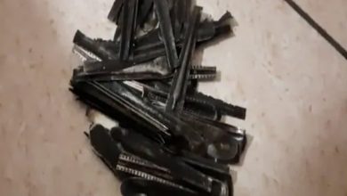 Photo of युवक के पेट से निकला 63 स्टील का चम्मच, मामला जानकर डॉक्टर्स भी हो गए हैरान