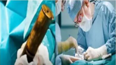 Photo of साफ-सफाई के दौरान एक्स सर्विसमैन के प्राइवेट पार्ट में फंस गया बम, फिर सामने आया ये चौकाने वाला मामला