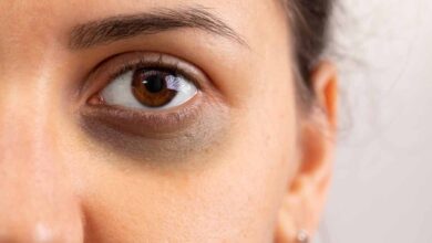 Photo of आइए जानें कि आंखों के नीचे काले घेरों या फिर सूजन के  कारण और इलाज क्या है?