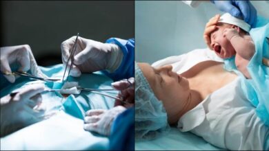 Photo of तो चलिए जानते हैं सी-सेक्शन से जुड़े कुछ आम मिथक और उनकी सच्चाई-