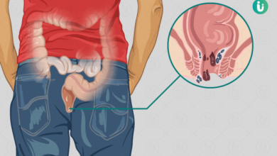 Photo of अगर आपको ये रोग है तो इसे इग्नोर ना करें, क्योंकि ये खतरनाक हो सकती है, जानिए छुटकारे के लिए आसान तरीके