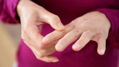 Photo of शरीर में विटामिंस की कमी होने पर दिखाई देते है ये लक्षण-