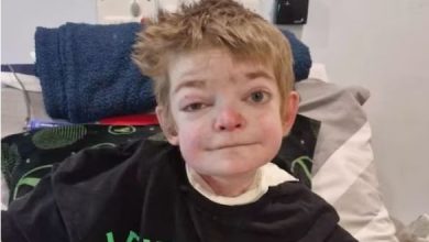 Photo of जिंदा होकर भी करवाएगा खुद का अंतिम संस्कार, दुर्लभ बीमारी है इसकी वजह!