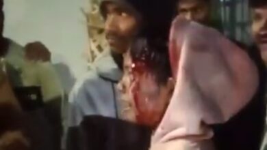 Photo of कैनाल रोड, देहरादून पर बच्ची पर गुलदार ने किया जानलेवा हमला