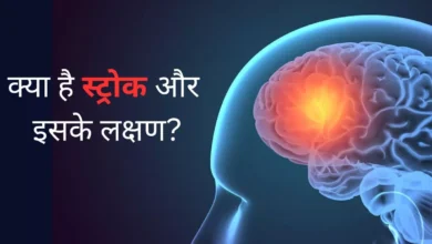 Photo of क्या है Stroke जो कभी भी ले सकता है आपकी जान, जानें इसके लक्षण