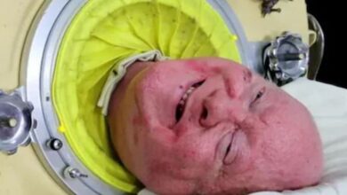 Photo of 7 फीट लंबा ‘लोहे का फेफड़ा’, 70 सालों से ‘सीने में लिए घूम रहा था’ शख्स!