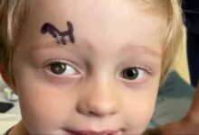 Photo of बेटे की आंख में दिखी ‘सफेद चमक’, तुरंत पहुंची हॉस्पिटल, पता चला भयावह कारण