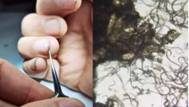 Photo of शख्स ने नाखून में से निकाला मैल, माइक्रोस्कोप में दिखाई असलियत!