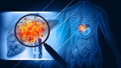 Photo of दिल्ली : लिवर कैंसर की पहचान सरल बनाएगा एआई