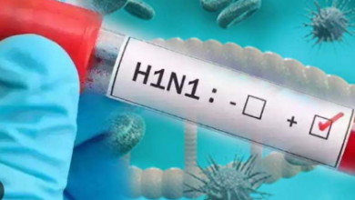 Photo of यूपी में हुई स्वाइन फ्लू की एंट्री; आगरा में एक महिला में मिला Influenza H1N1