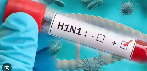 Photo of यूपी में हुई स्वाइन फ्लू की एंट्री; आगरा में एक महिला में मिला Influenza H1N1