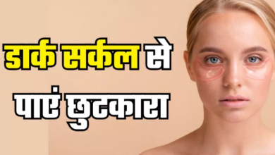 Photo of चेहरे की खूबसूरती कम कर सकता है डार्क सर्कल