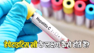 Photo of उत्तराखण्ड में सामने आए 100 से ज्यादा Hepatitis C के मामले