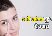 Photo of आपकी खूबसूरती में दाग लगा सकते हैं Dark Circles