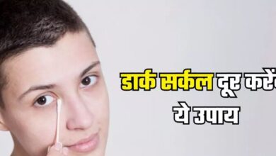 Photo of आपकी खूबसूरती में दाग लगा सकते हैं Dark Circles