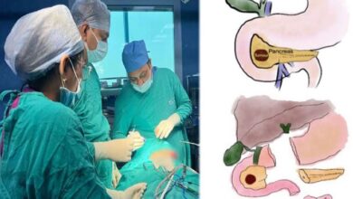 Photo of एम्स में दुनिया की सबसे छोटी मरीज: अग्नाशय के कैंसर से पीड़ित बच्ची की बचाई जान